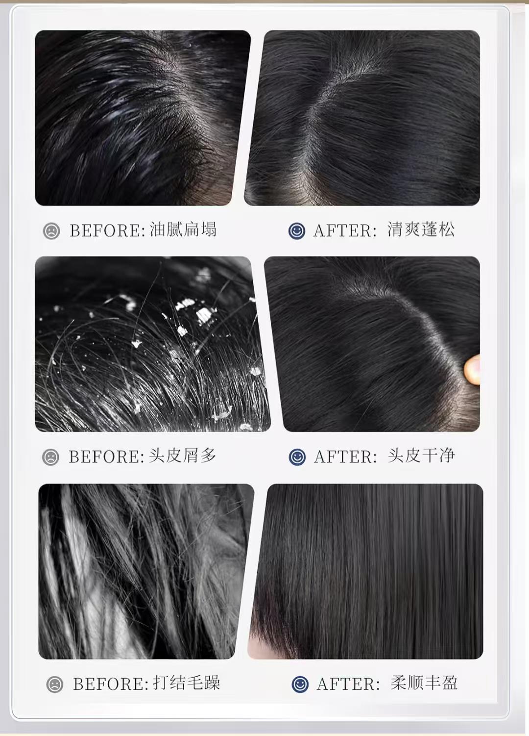 【曾芝林】沉香百草洗发乳 | Zeng Zhilin Agarwood Herbal Shampoo